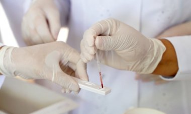 Saúde Estadual reforça importância da testagem para hepatites B e C durante campanha Julho Amarelo