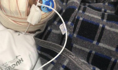 Bateria explode dentro de carro e deixa pai e filho gravemente feridos