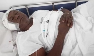 Indígena é atacado por onça ao acampar às margens de rio