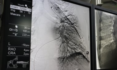 HGG passa a ser único hospital público a realizar angioplastia pulmonar por balão em Goiás