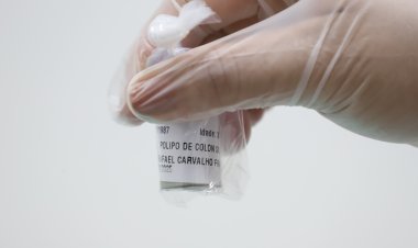 Saúde Estadual promove mutirão de prevenção ao câncer de intestino